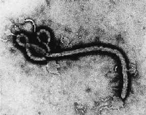 Ebola Virus